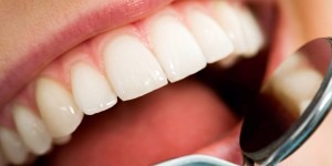 dentist's mirror being used to look into a patient's open mouth