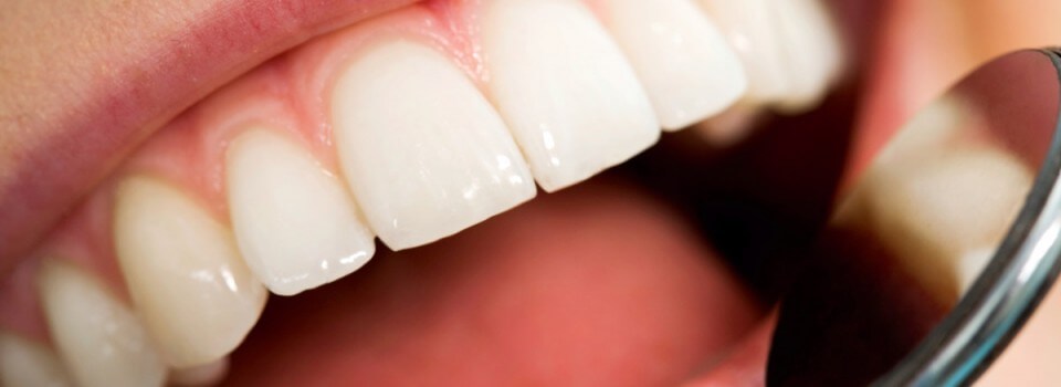 dentist's mirror being used to look into a patient's open mouth