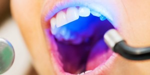 a dentist's ultraviolet light tool being used to examine a patient's mouth