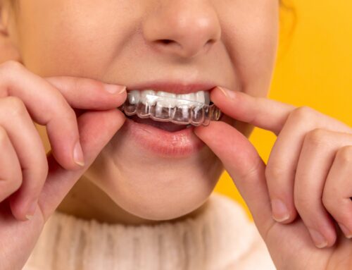 Choosing the Best Types of Braces For You – Will Smilelign meet your needs?