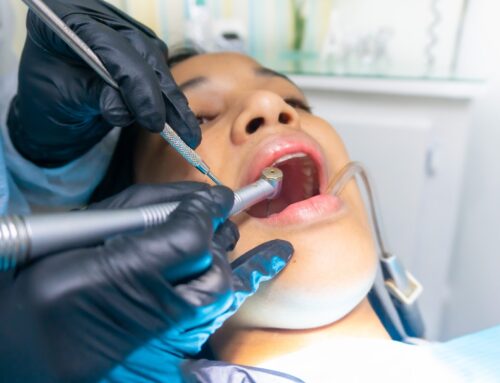 When is a Tooth Filling Necessary?